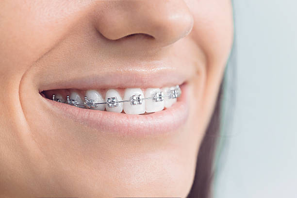 Best Veneers and Lumineers  in Herscher, IL